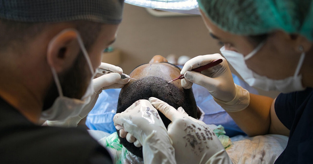 Close-up of follicular unit graft placement